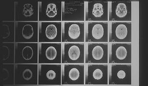 A head x-ray taken by a computer-assiste