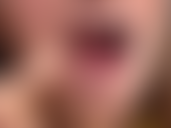 O que fazer com a perda de dentes?