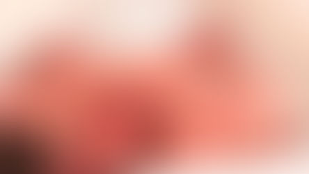 Parto prematuro: cause, sintomi, terapia del parto pretermine. Sopravvivenza del neonato prematuro. 