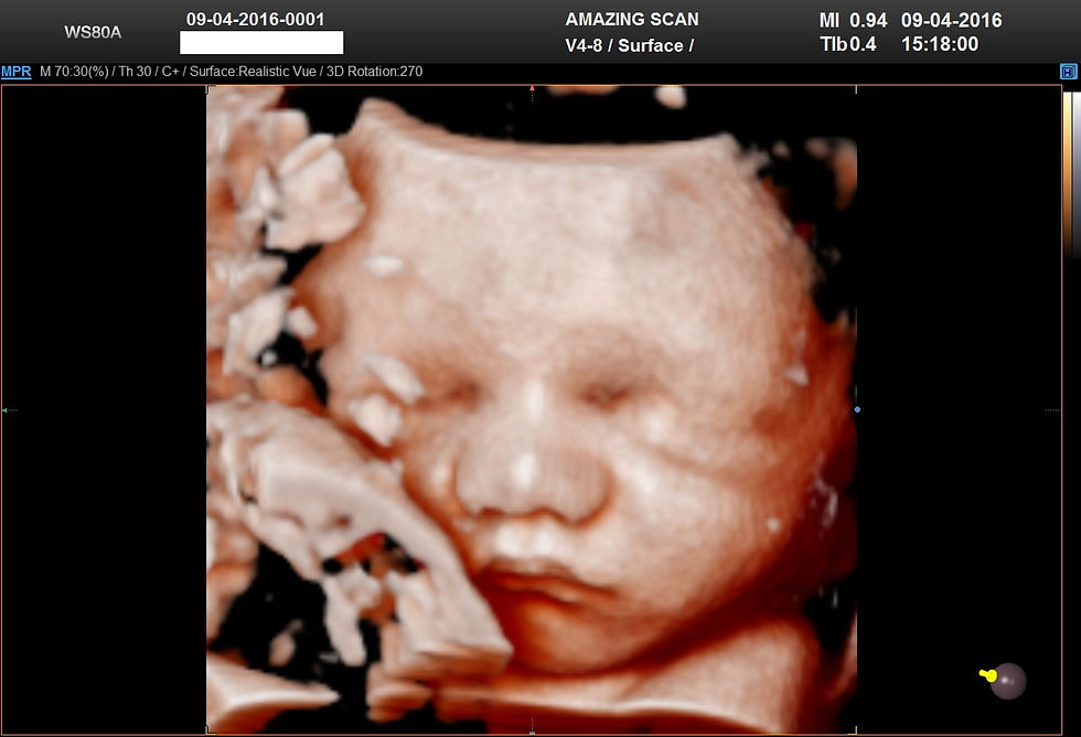 BABY_0045
