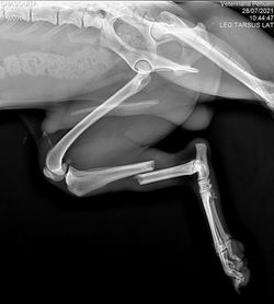 Radiografía digital