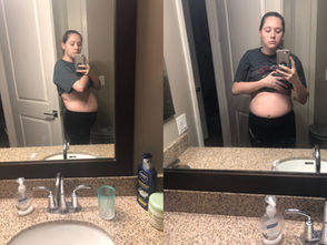 Called Upon By The Endo Belly