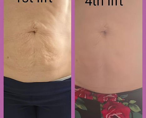 han collagen lift.jpg