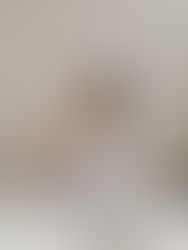 來自台灣生醫的突破，從癌症研究發現敏感肌的關鍵