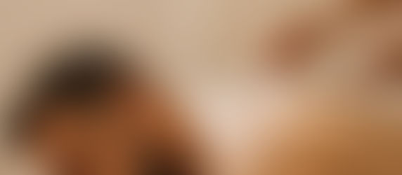 Thérapie par ventouses à sec et à froid