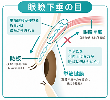 代官山 岸本眼科 アップニーク 眼瞼下垂