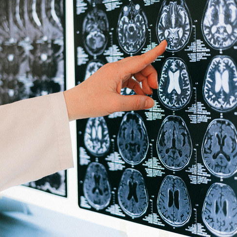 Doctor reviewing brain MRI scans