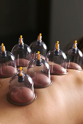 vacuum-cupping-massage-young-woman-line-massage-table.jpg