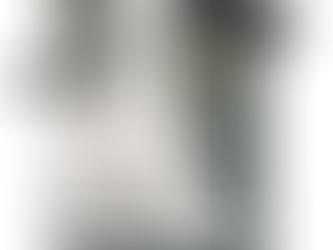 תמונת רנטגן של רגל בנעל עקב, עליה מונחים משקפי שמש שחורים וצמיד זהב