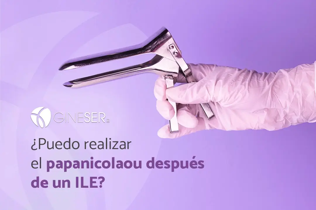 Imagen con un espéculo cusco de acero inoxidable