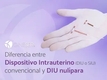 Diferencia entre Dispositivo Intrauterino (DIU o SIU) convencional y DIU nulípara.