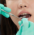 tooth extraction, dental extraction
