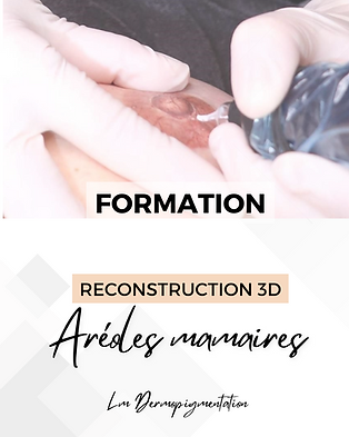 Areole Avantaprès  (2).png