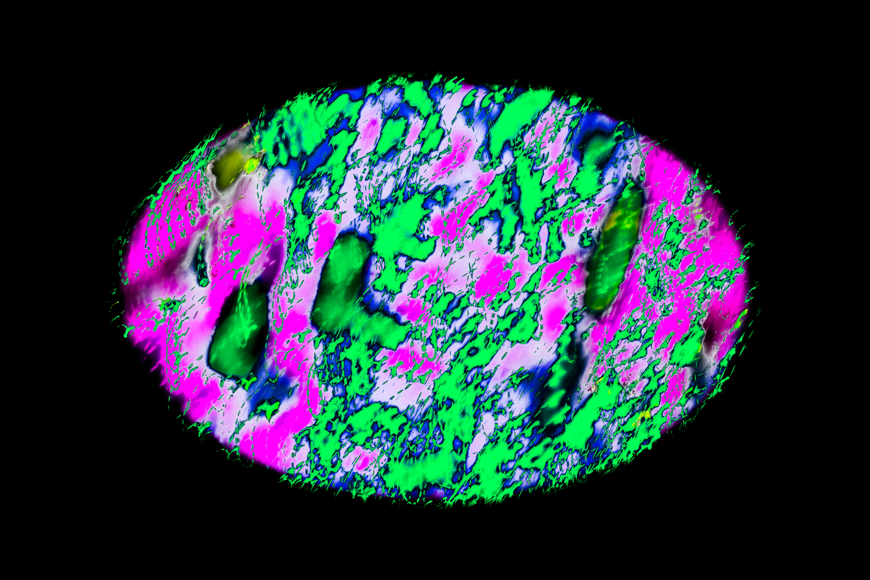 Vignette Landscape - Digital