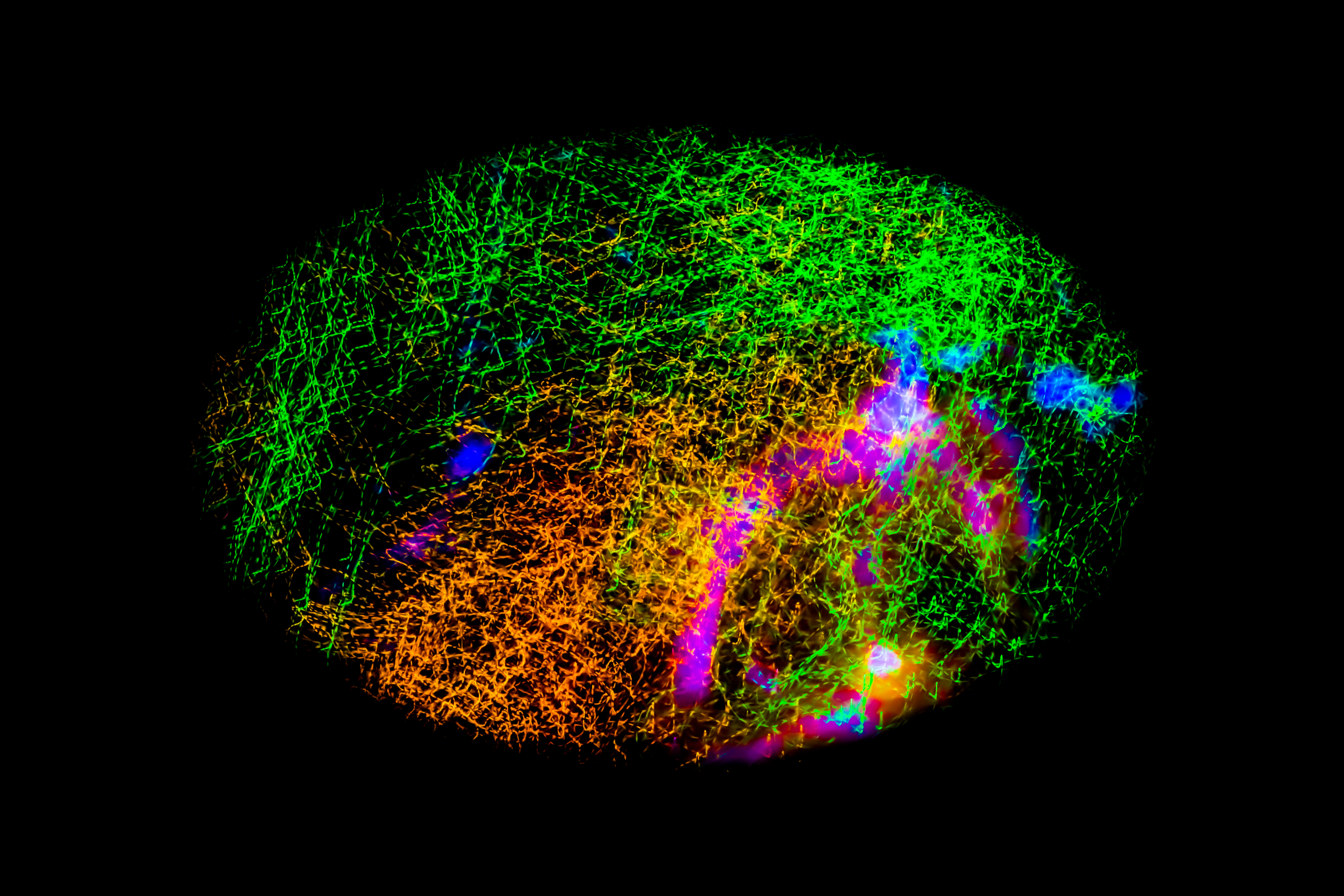 Vignette Landscape - Digital