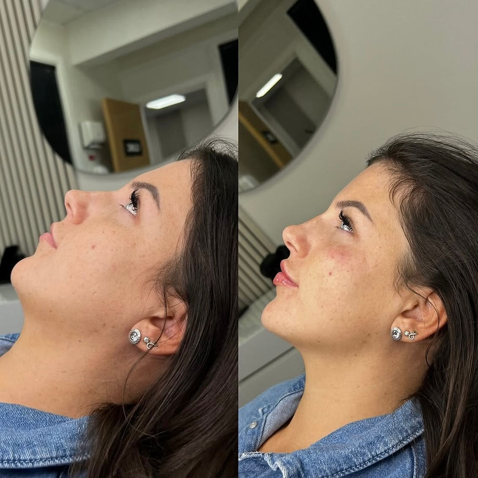 1-1 Facial Contouring Masterclass £999