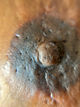 Close-up of an areola corrected through 3D tattooing, improving color, coverage, and overall appearance on scarred tissue.