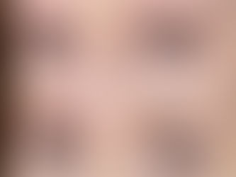 How long does microblading last?