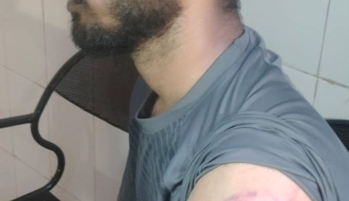 ಗಣೇಶ ದರ್ಶನ ಮುಗಿಸಿ ಮರಳುತ್ತಿದ್ದ ಯುವಕನ ಮೇಲೆ ಲಾಠಿ ಪ್ರಹಾರ