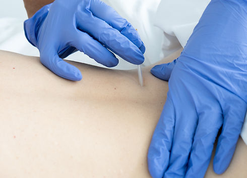 child getting physical therapy