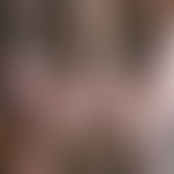 Understanding Osteoarthritis: Symptoms, Diagnosis, and Natural Remedies