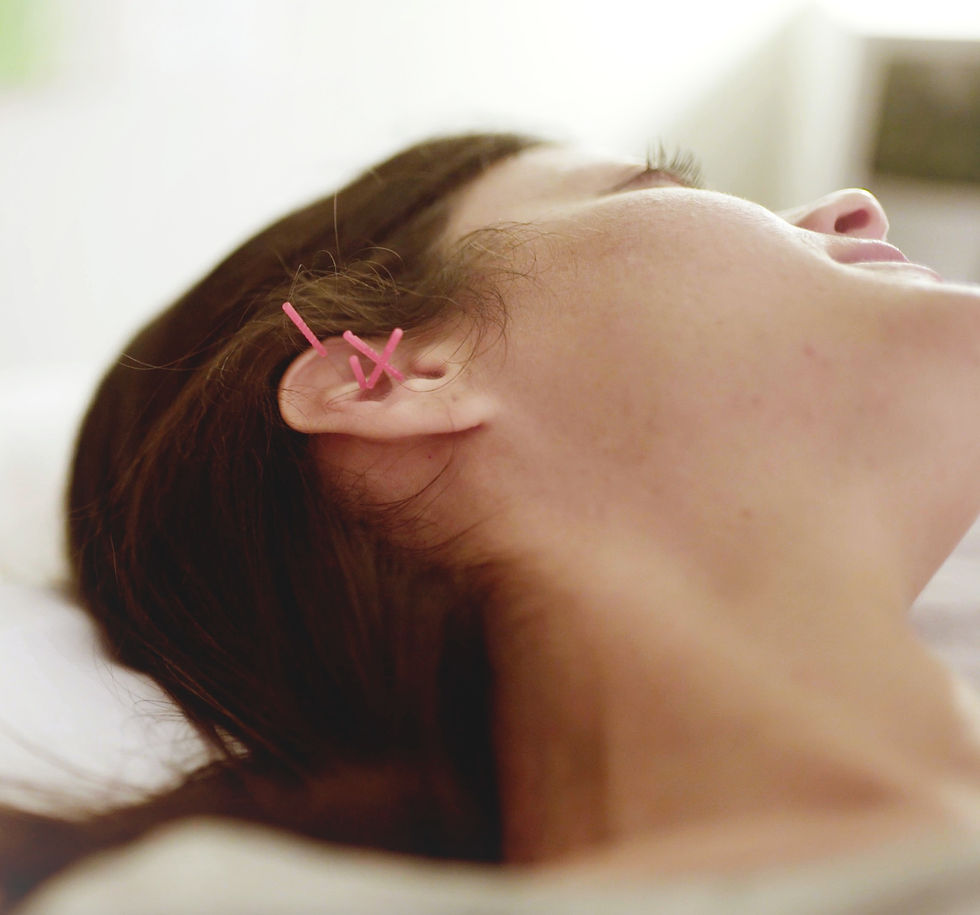 Five ear acupuncture detox points