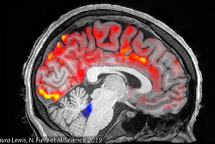 Deep Sleep Triggers Waves of Fluid to Flush Toxins From Brain During Slumber