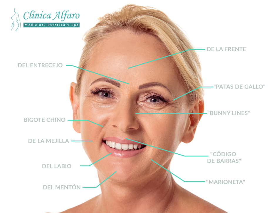 Reconoce las arrugas faciales | Clínica Alfaro | Heredia CR