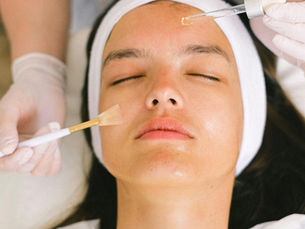 5 Common Myths About Chemical Peels — Debunked