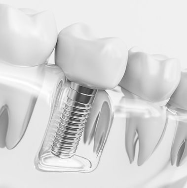 CONTENIDO DE REDES SOCIALES SALUD BUCAL.