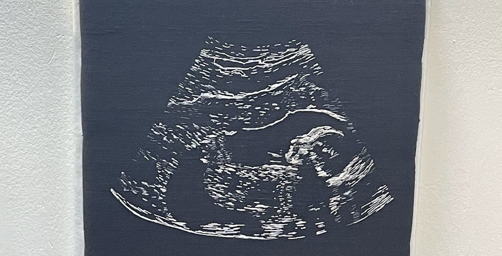 Wondrous Womb - Pauline Medinger