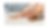 Close-up view of a foot undergoing cheilectomy surgery