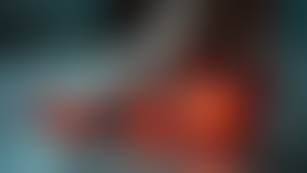 Foot pain from stress fracture