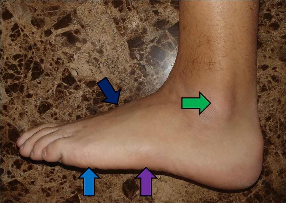 Surface Anatomy of the Foot