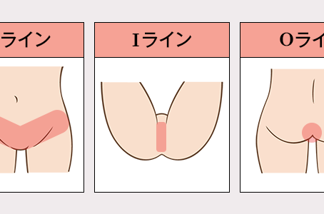 ブラジリアンワックスモニター（VIO・メンズ）募集
