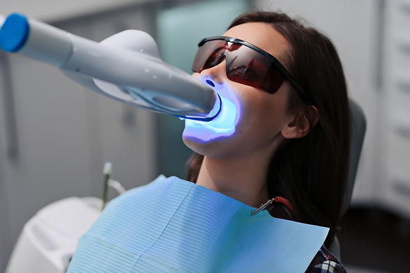 Dental Devotion - Teeth Whitening