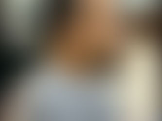 Hair loss doesn’t happen overnight