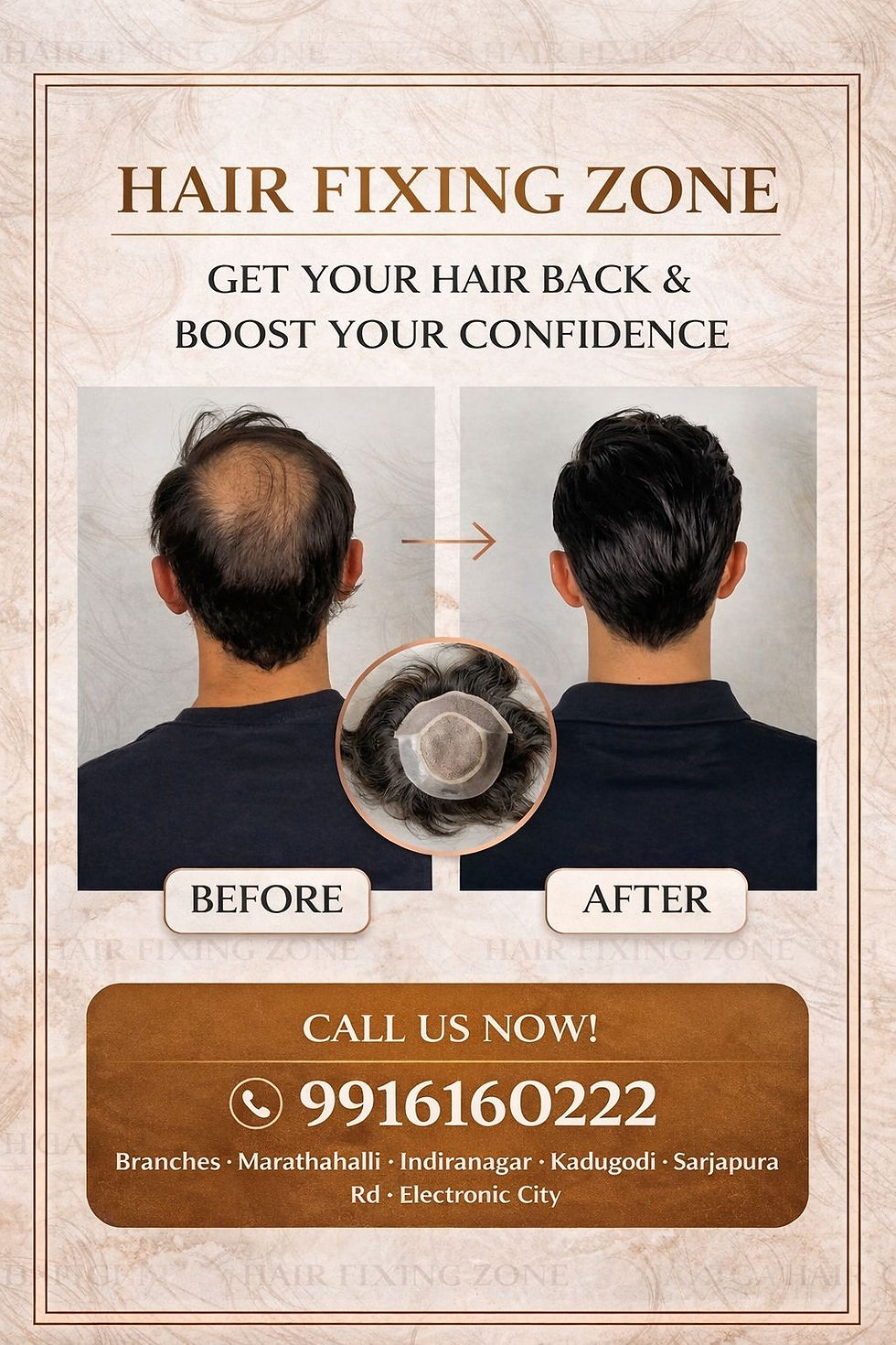 Bald spots don’t define you. Confidence does!