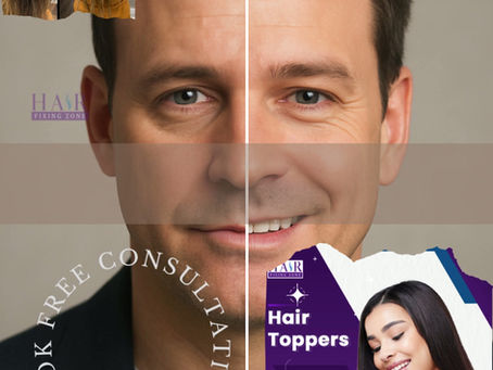 Balding? Don’t worry – fix it instantly! 💇♂️🎉