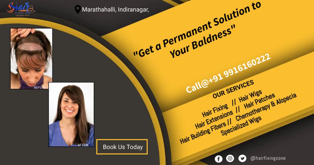 Natural Looking Hair Patches And Wigs For Men & Women