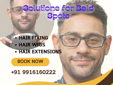 Solutions for Bald Spots at Hair Fixing Zone!
