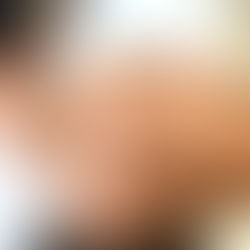 Brazilian Manual Lymphatic Drainage is a refined version of traditional lymphatic drainage techniques. It was developed in Brazil with a focus on gentle, rhythmic movements that follow the natural pathways of the lymphatic system. The technique emphasizes: