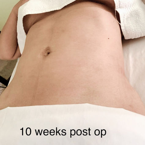 Understanding Post-Cosmetic Surgery Therapy Care and Neria Beauty Techniques