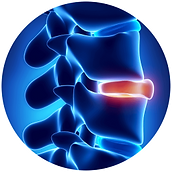 Herniated-Disc-uai-258x258.png