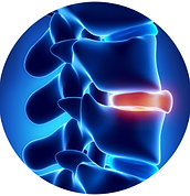 Herniated-Disc-uai-258x258.png