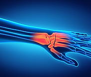 wrist.png