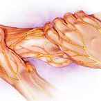 peripheral-neuropathy-150x150.jpg