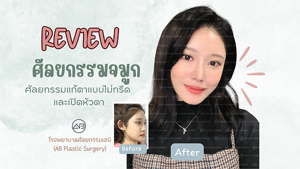 รีวิวศัลยกรรมจมูกและตา ที่มีแต่คนชมไม่หยุด จากโรงพยาบาลเอบี (AB Plastic Surgery)