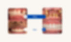 Beige Minimalist Skincare Before and After Instagram Post (Site) (1)_edited.jpg