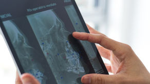 Zumbido e DTM: entenda a relação entre o ouvido e a mandíbula